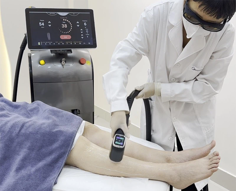 4 Wavelength 3000W Diode Laser Hair Removal Machine – Permanent, Painless, And Professional Solution price