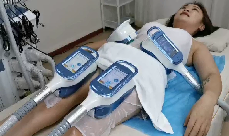 Best Cryolipolysis Antifreeze Membranes