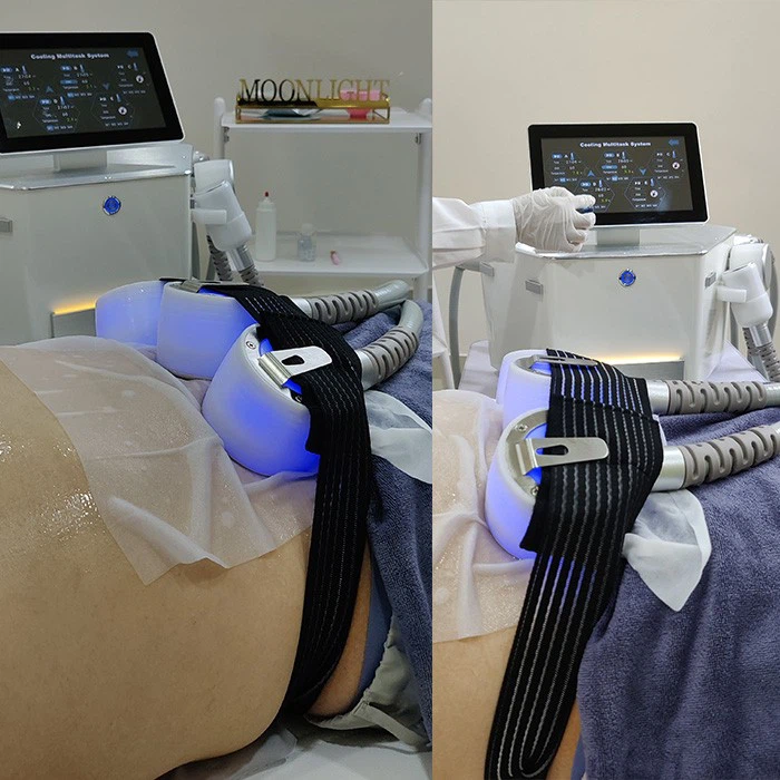 Best Cryolipolysis Antifreeze Membranes