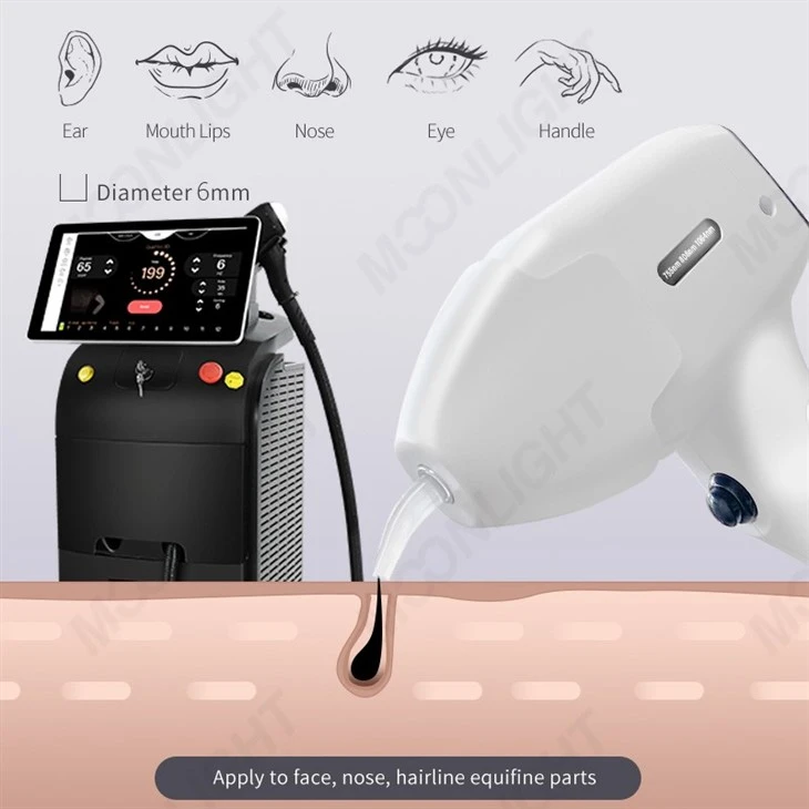 High Quality Laser Hair Removal Machine