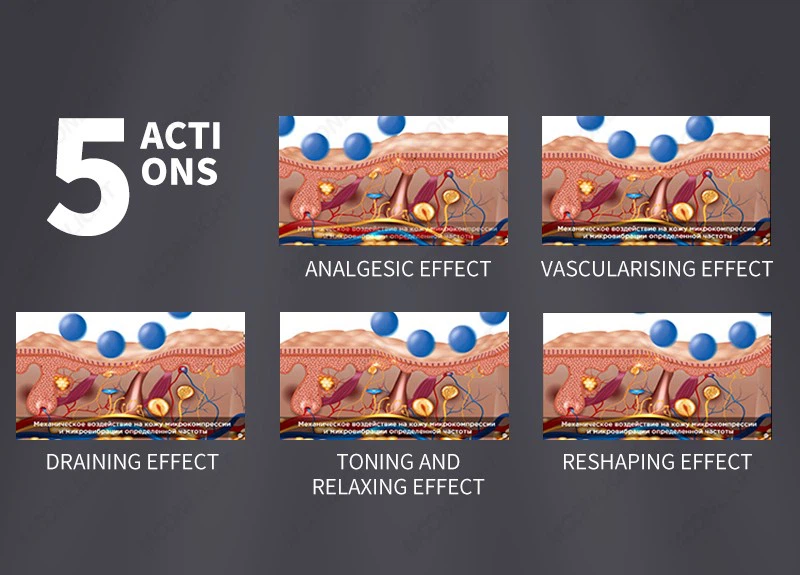 MNLT Endosphere Machine suppliers